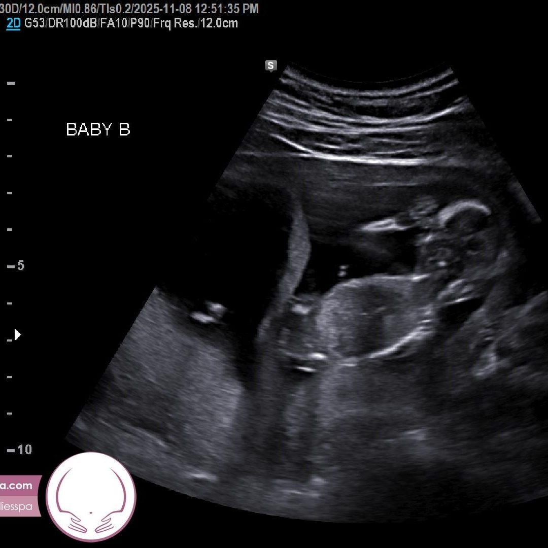 Photo shared by Casey for their Babylist baby registry.