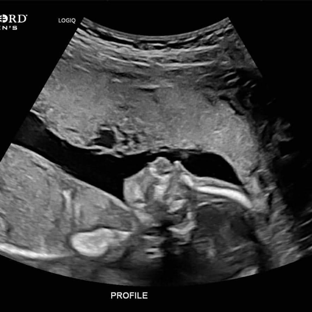 Photo shared by Zelda for their Babylist baby registry.