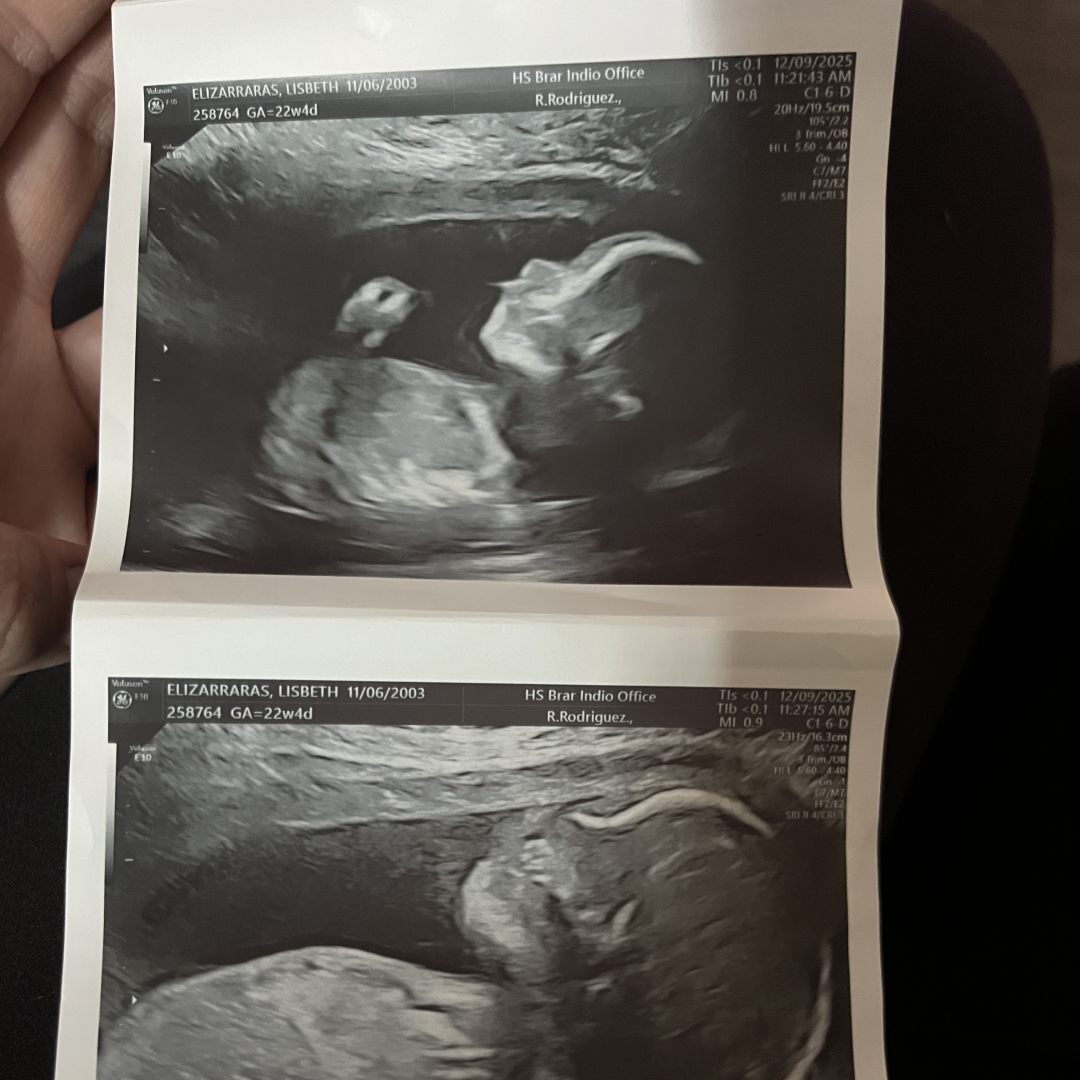 Photo shared by Lisbeth for their Babylist baby registry.