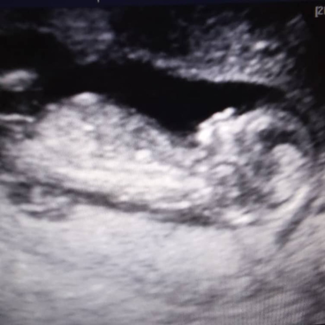 Photo shared by Lisandra for their Babylist baby registry.