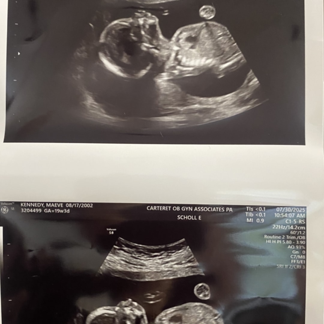 Photo shared by Maeve for their Babylist baby registry.