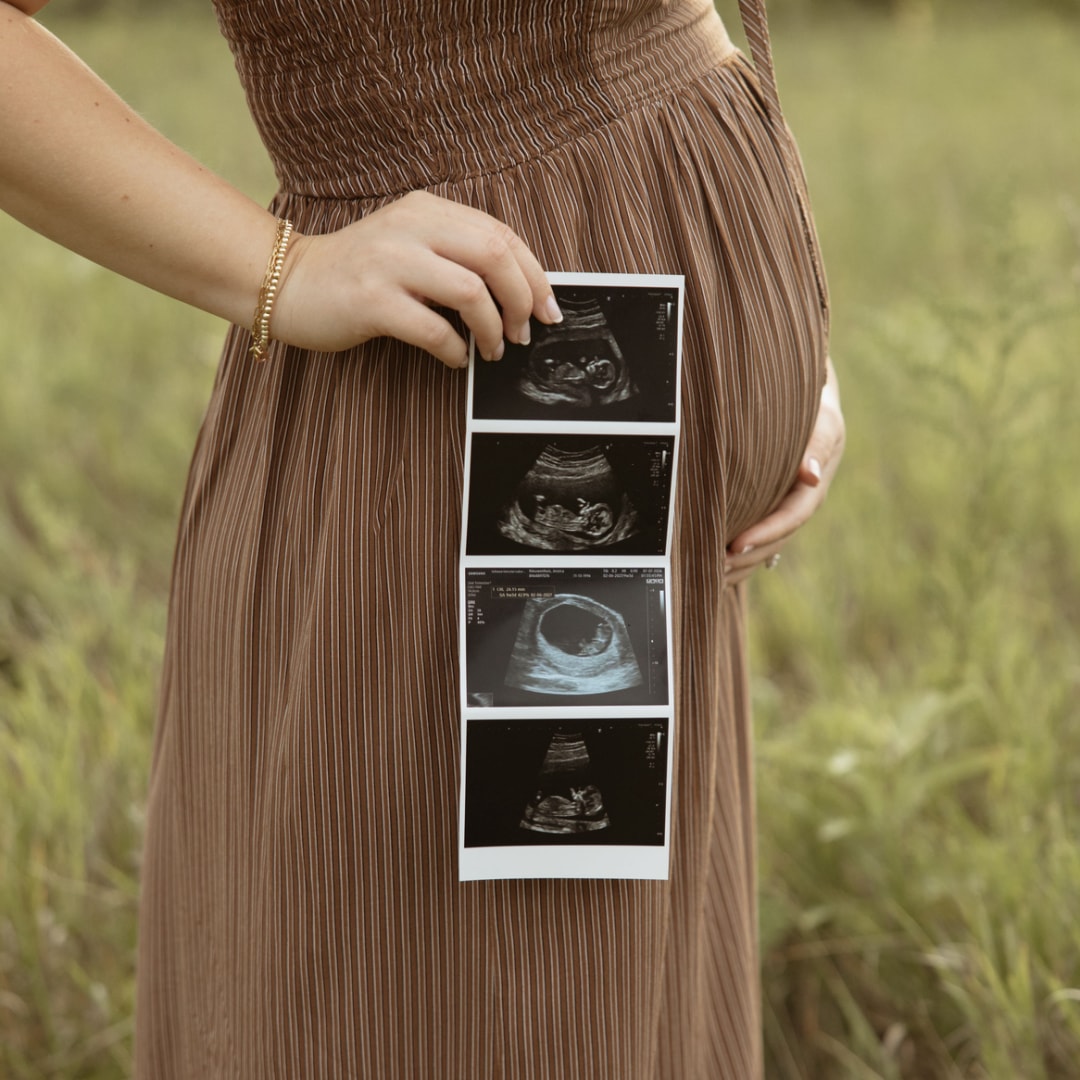 Photo shared by Jess & Josh for their Babylist baby registry.