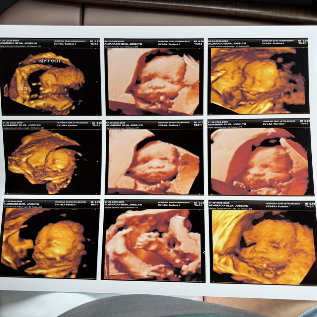 Photo shared by Joselyn for their Babylist baby registry.