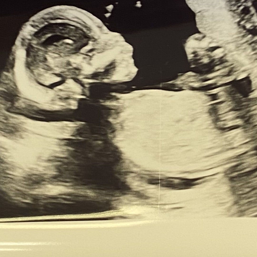 Photo shared by Alina for their Babylist baby registry.