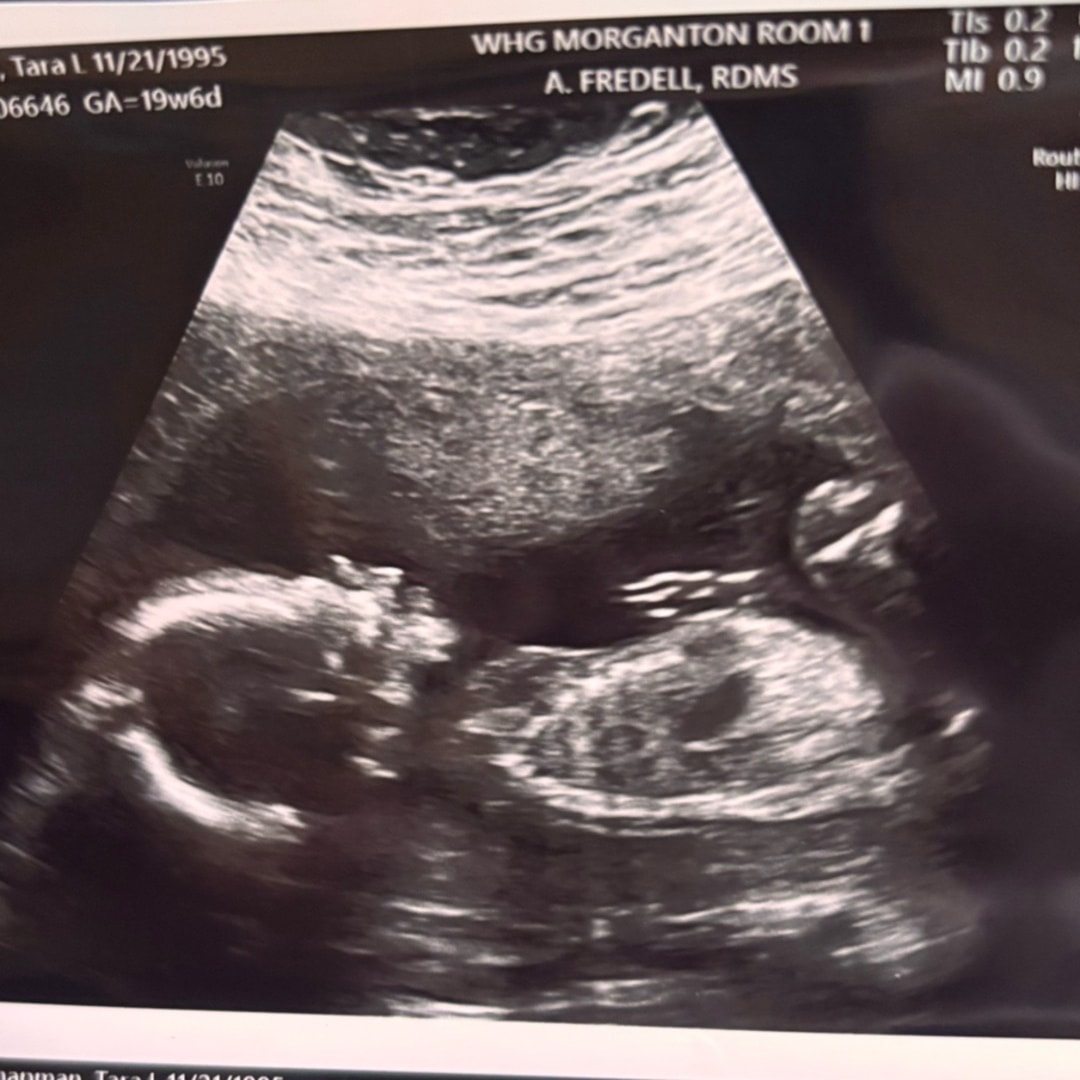 Photo shared by Tara for their Babylist baby registry.