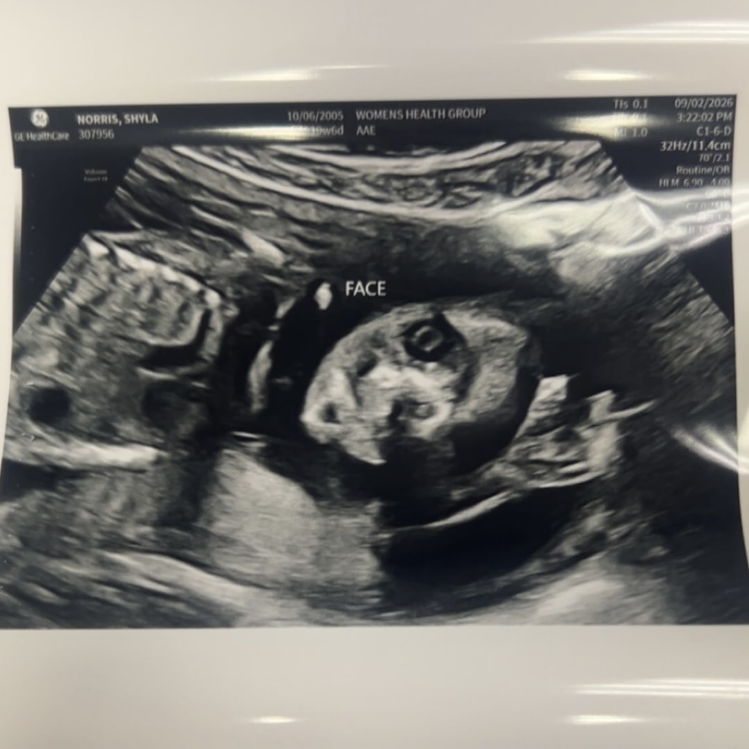 Photo shared by Shyla for their Babylist baby registry.