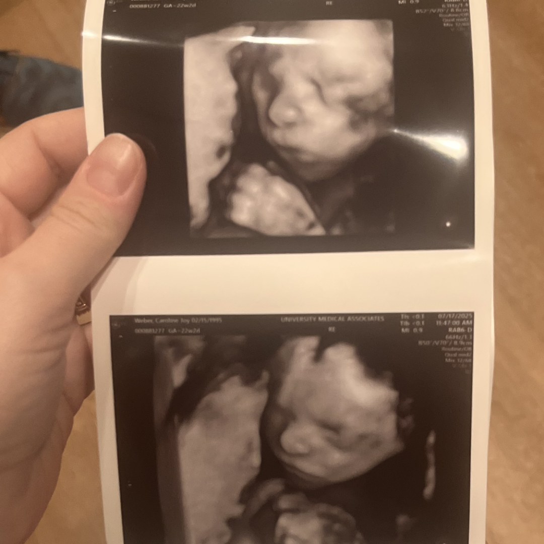 Photo shared by Caroline for their Babylist baby registry.