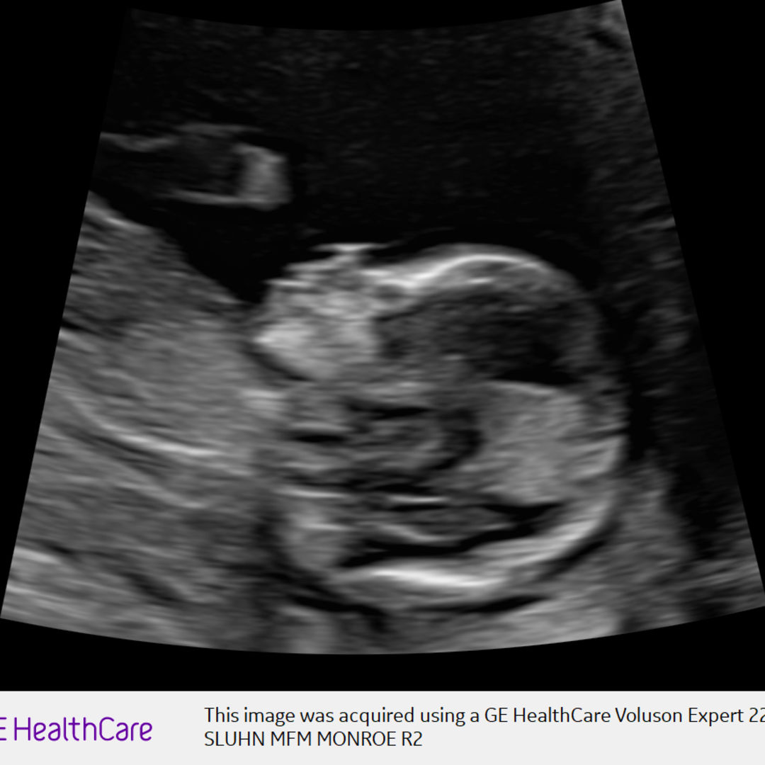 Photo shared by Brandy for their Babylist baby registry.