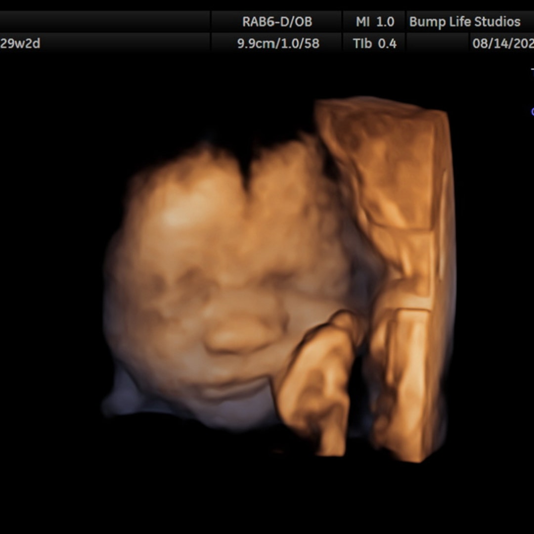 Photo shared by Brittney for their Babylist baby registry.