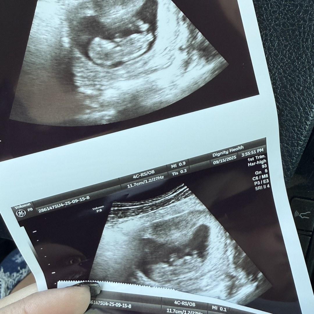 Photo shared by Amanda for their Babylist baby registry.