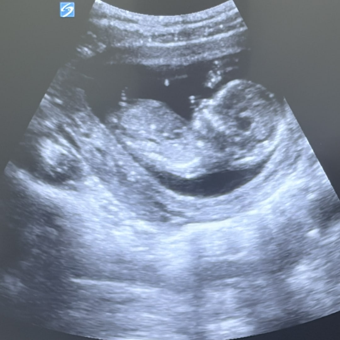 Photo shared by Alessandra for their Babylist baby registry.
