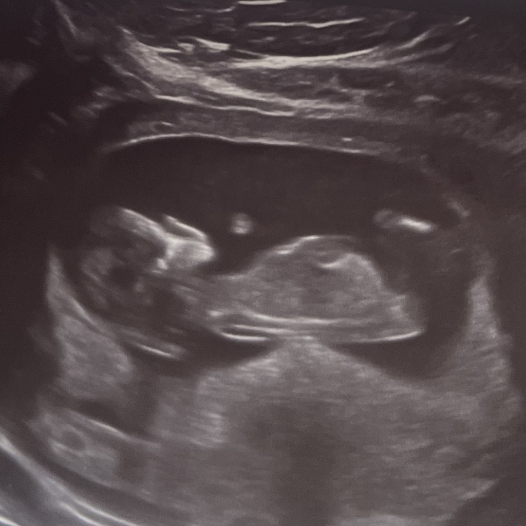 Photo shared by Michelle for their Babylist baby registry.