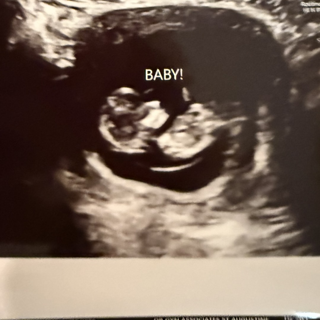 Photo shared by Brooke for their Babylist baby registry.