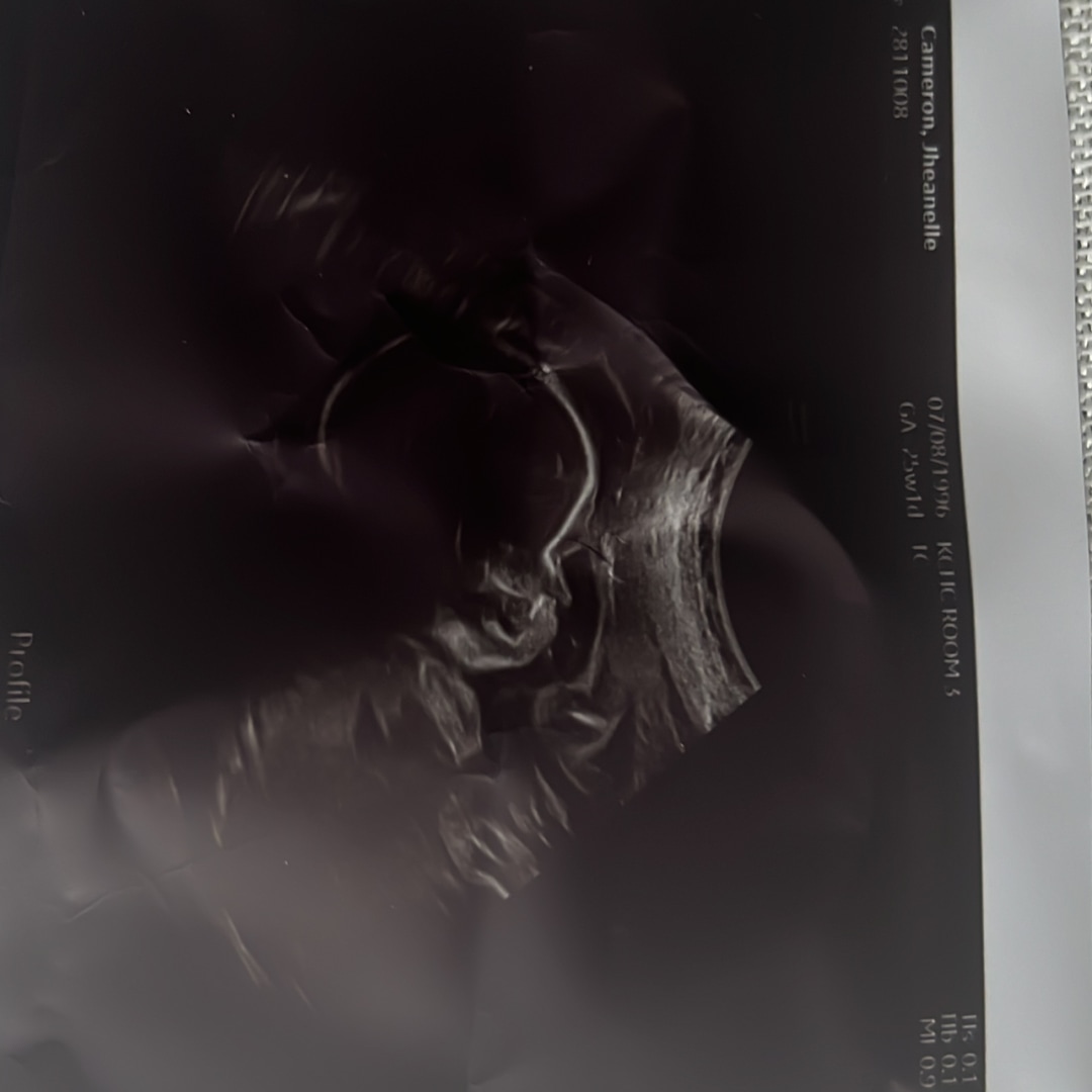Photo shared by Jheanelle for their Babylist baby registry.