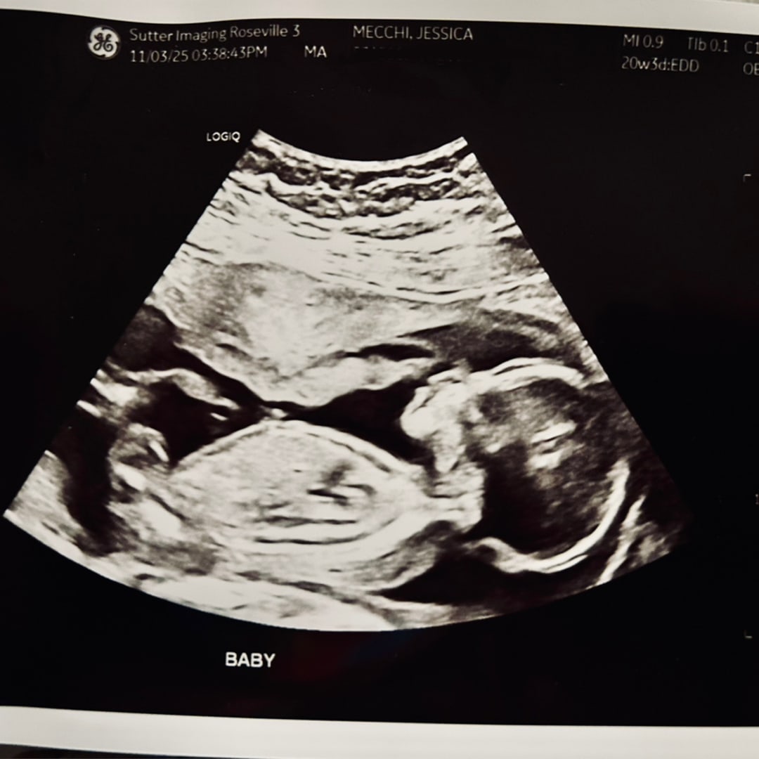 Photo shared by Jessica & Morgan for their Babylist baby registry.