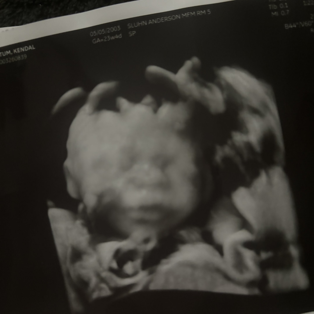 Photo shared by Kendal for their Babylist baby registry.
