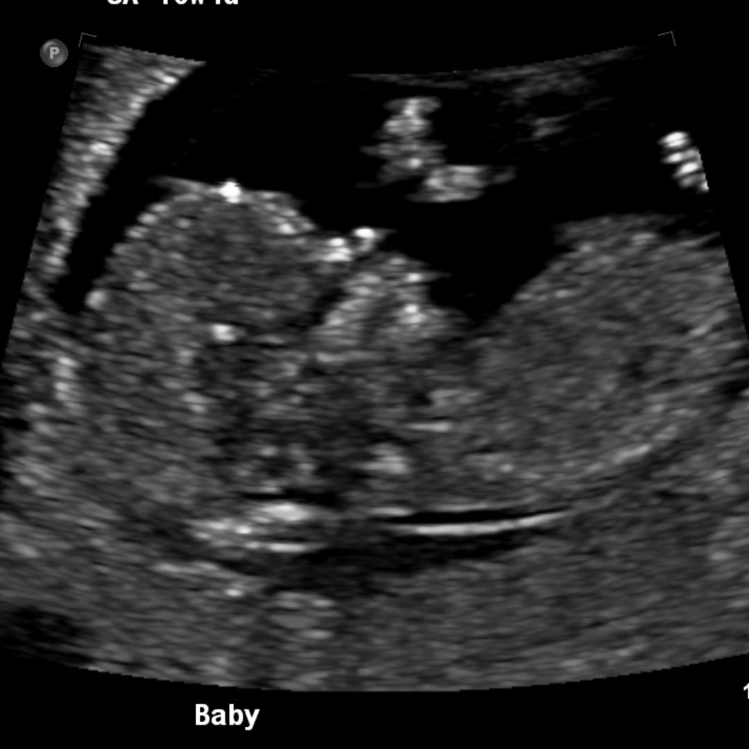Photo shared by Delaney for their Babylist baby registry.