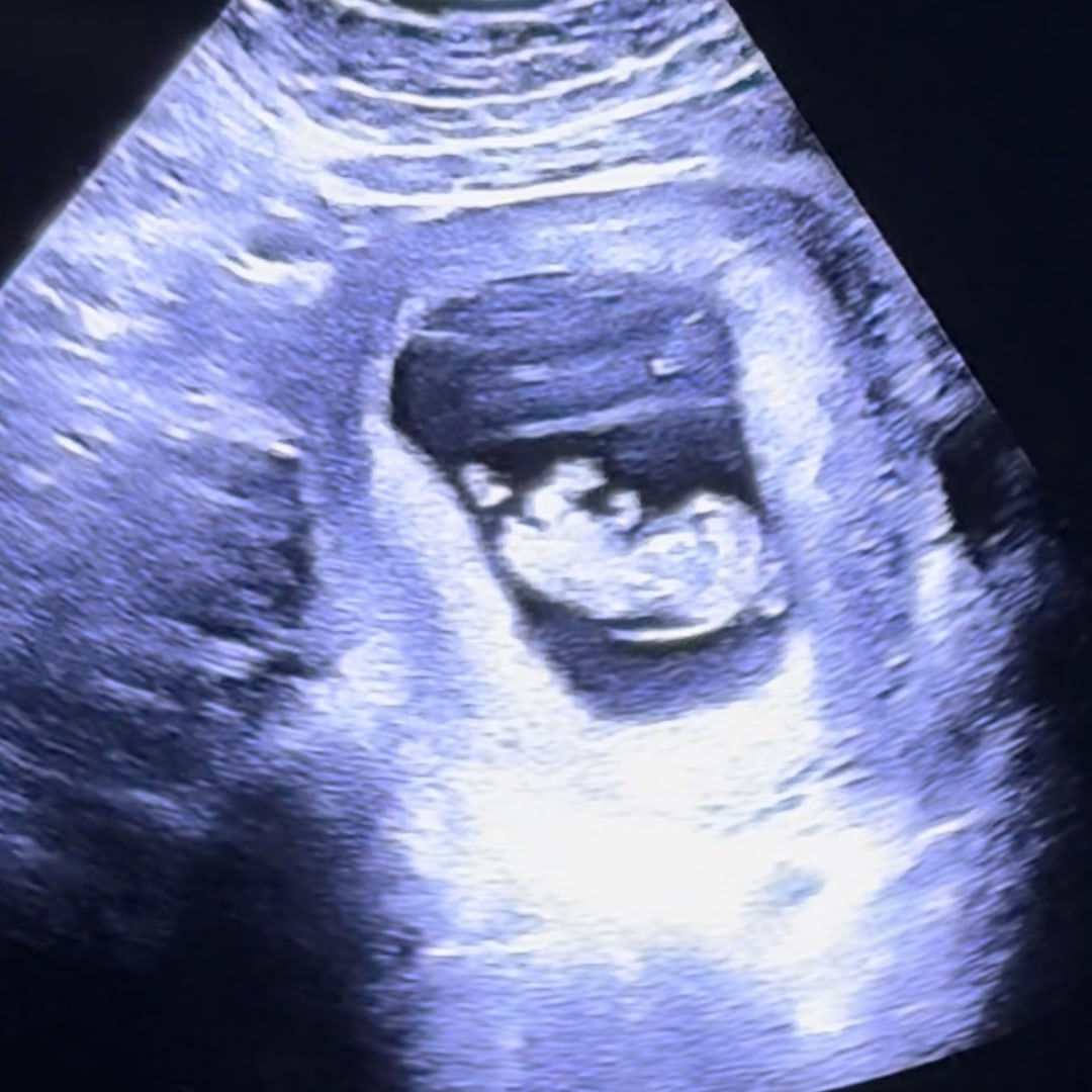 Photo shared by Jennifer for their Babylist baby registry.