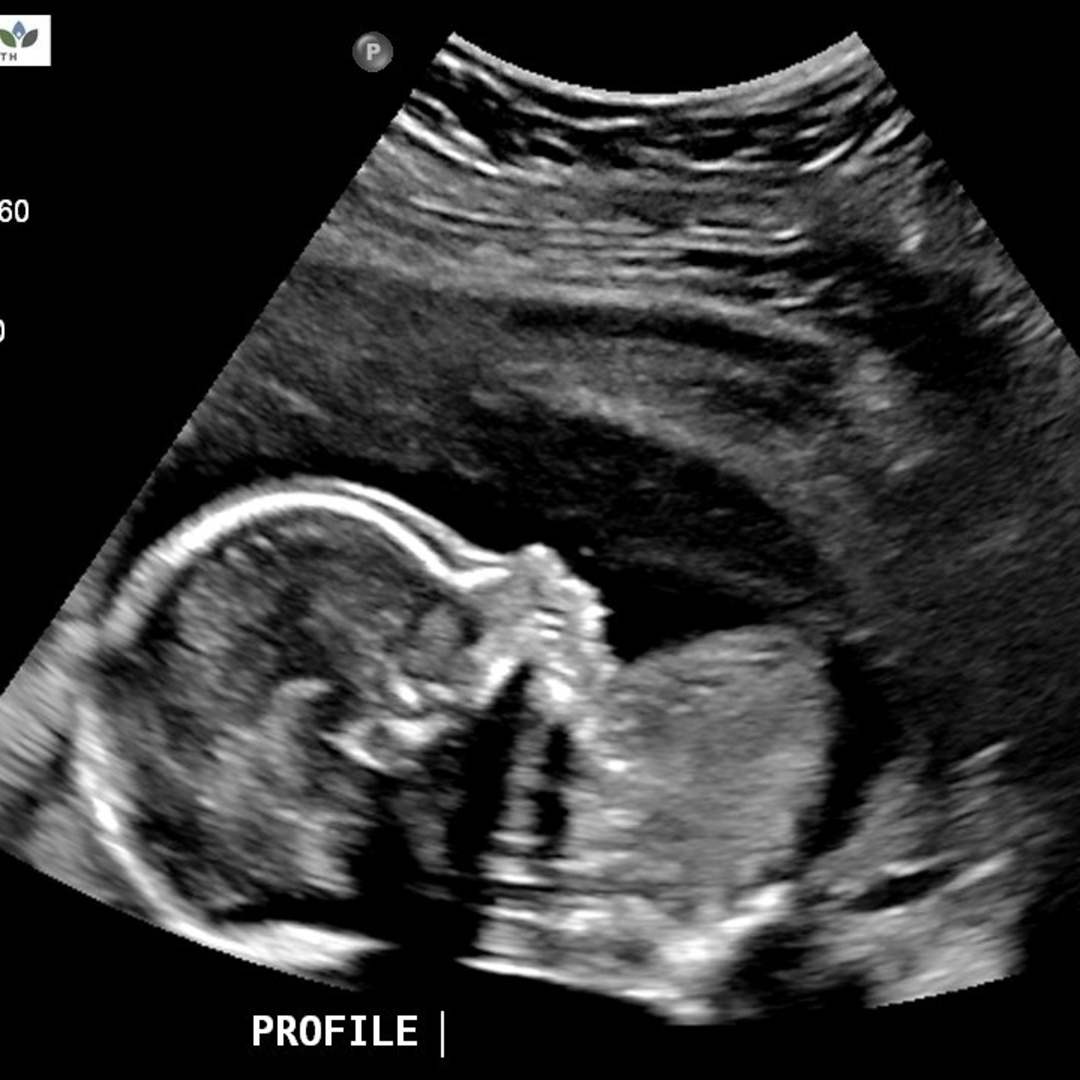 Photo shared by Sara for their Babylist baby registry.