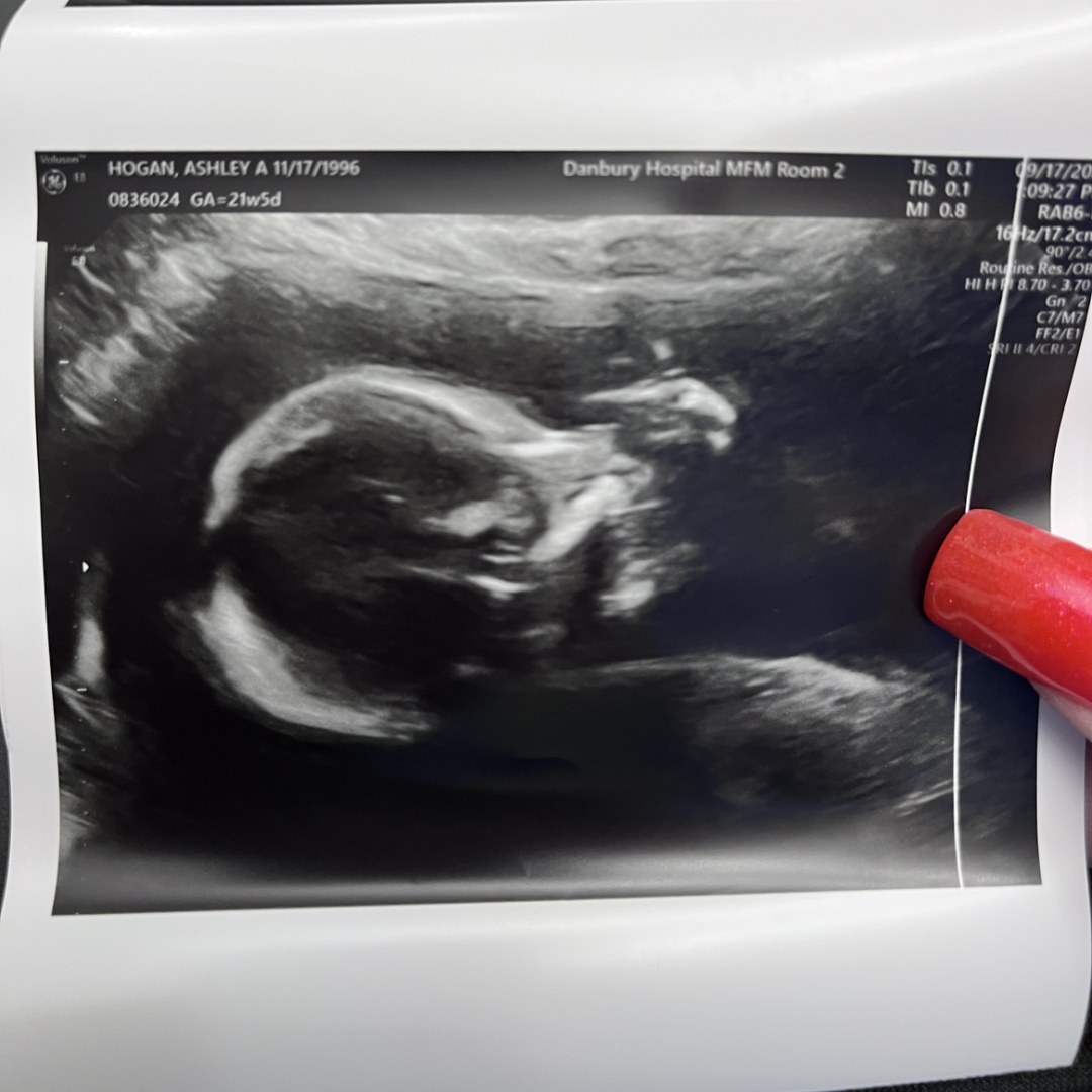 Photo shared by Ashley for their Babylist baby registry.