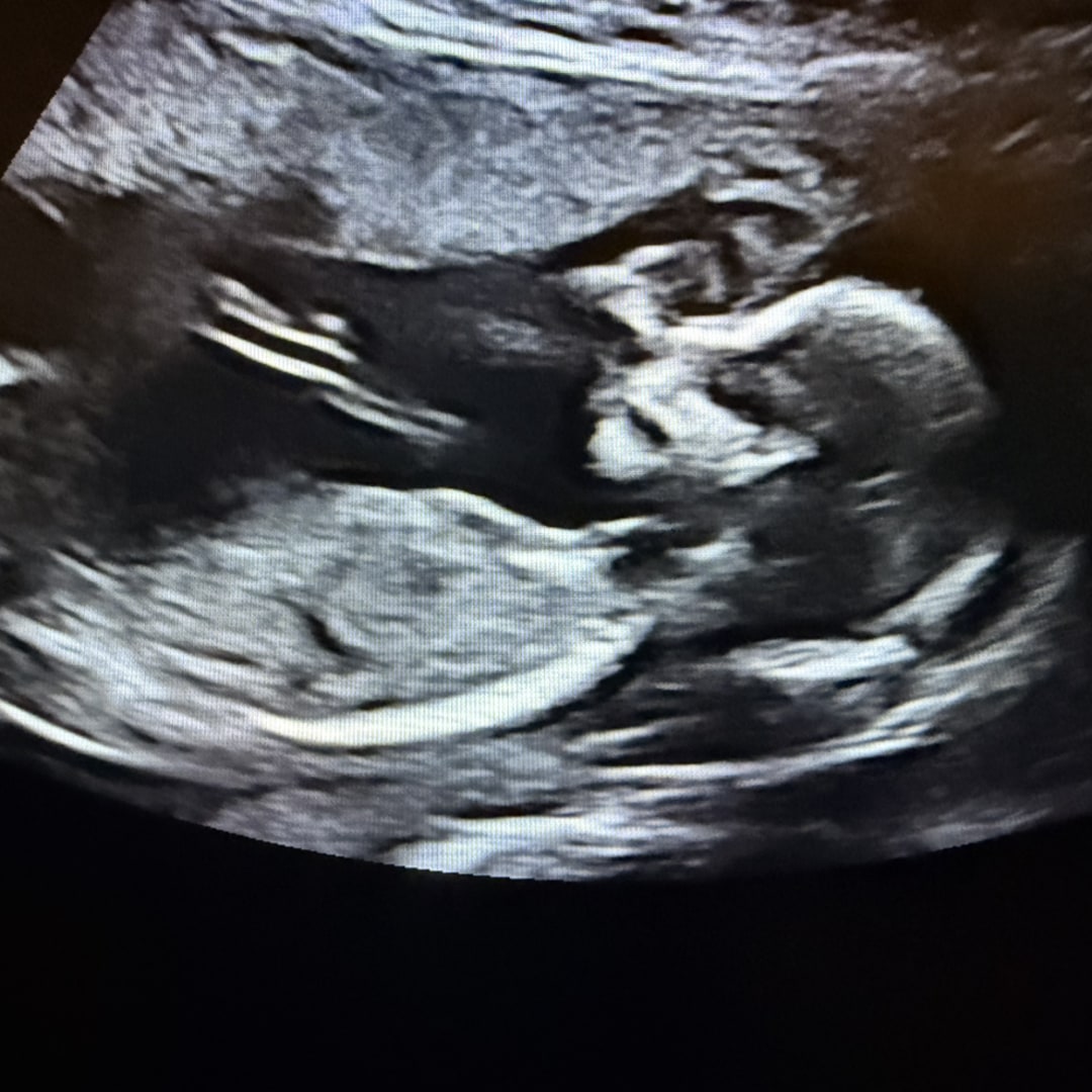 Photo shared by Kayla for their Babylist baby registry.