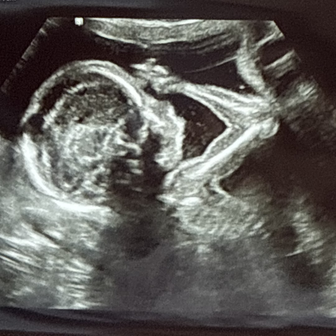 Photo shared by Lexie for their Babylist baby registry.