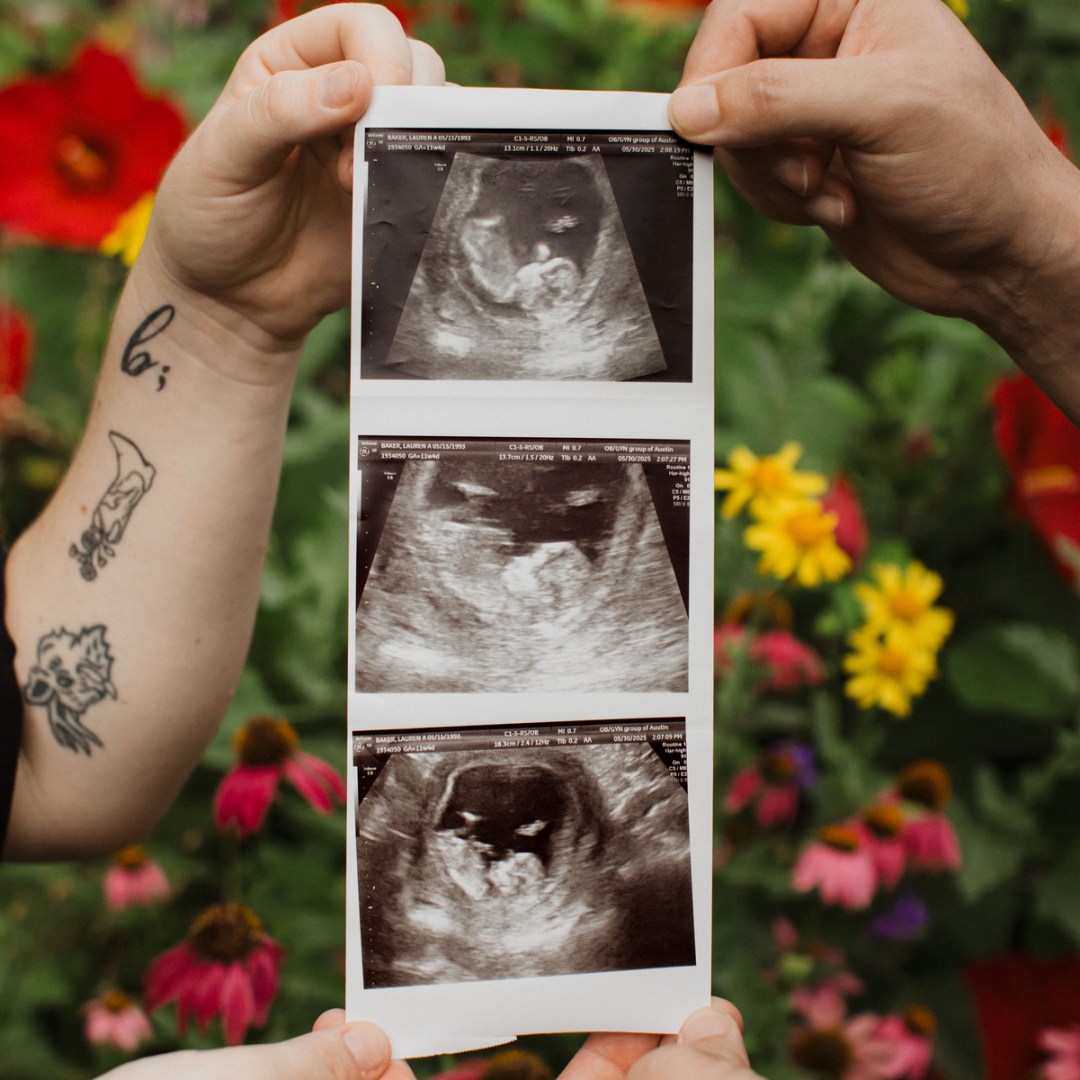 Photo shared by Lauren for their Babylist baby registry.