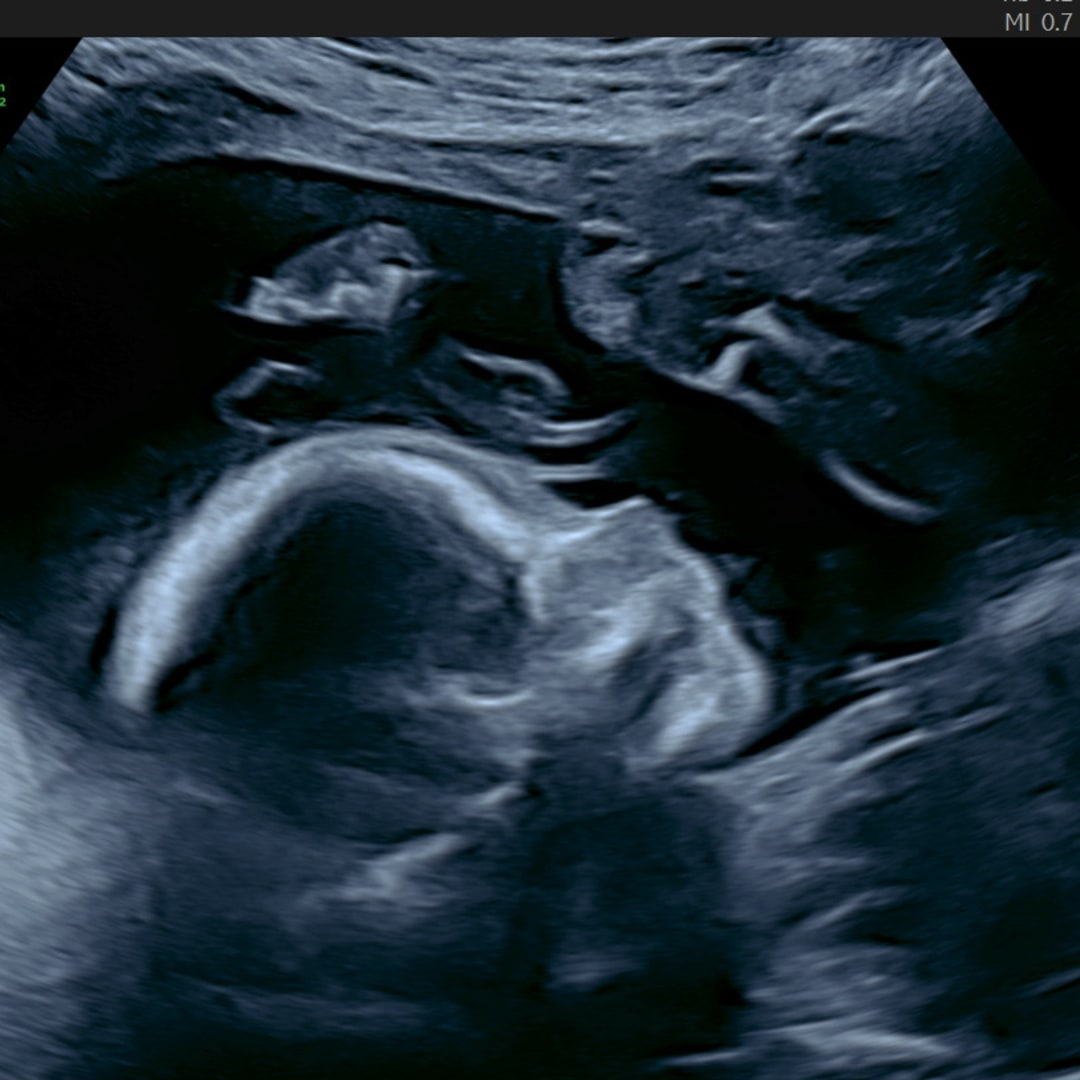 Photo shared by Carly for their Babylist baby registry.