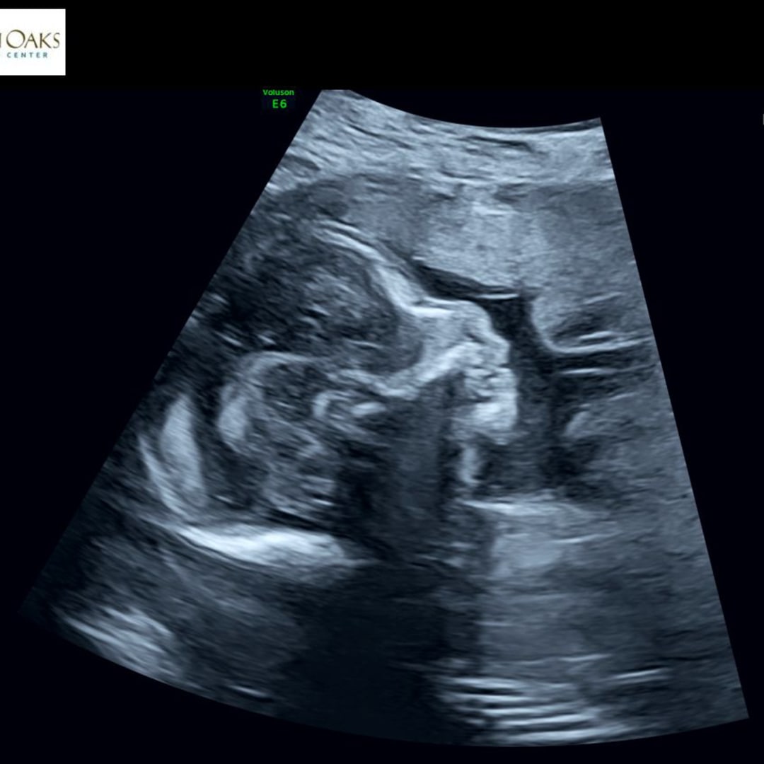 Photo shared by Alexis for their Babylist baby registry.