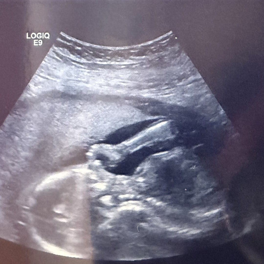 Photo shared by Natasha for their Babylist baby registry.