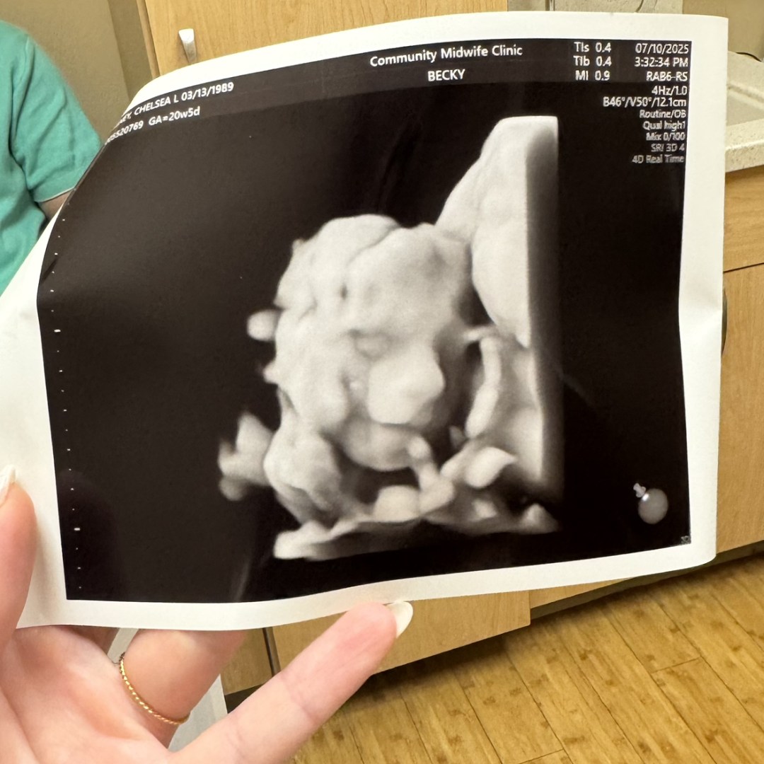 Photo shared by Chelsea for their Babylist baby registry.
