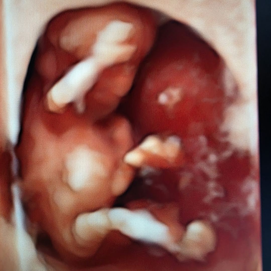 Photo shared by ALEJANDRA for their Babylist baby registry.
