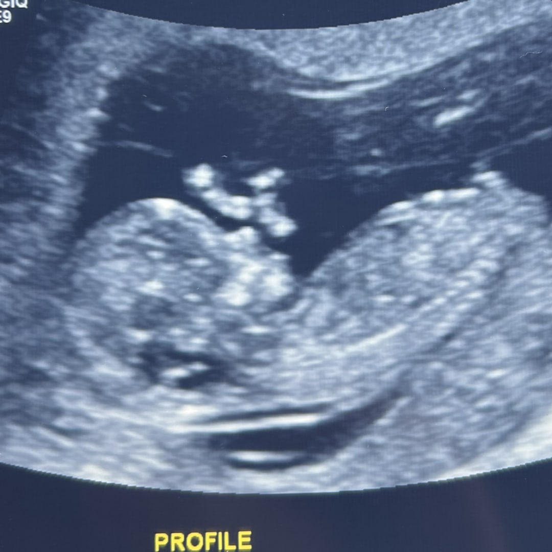 Photo shared by Annie for their Babylist baby registry.