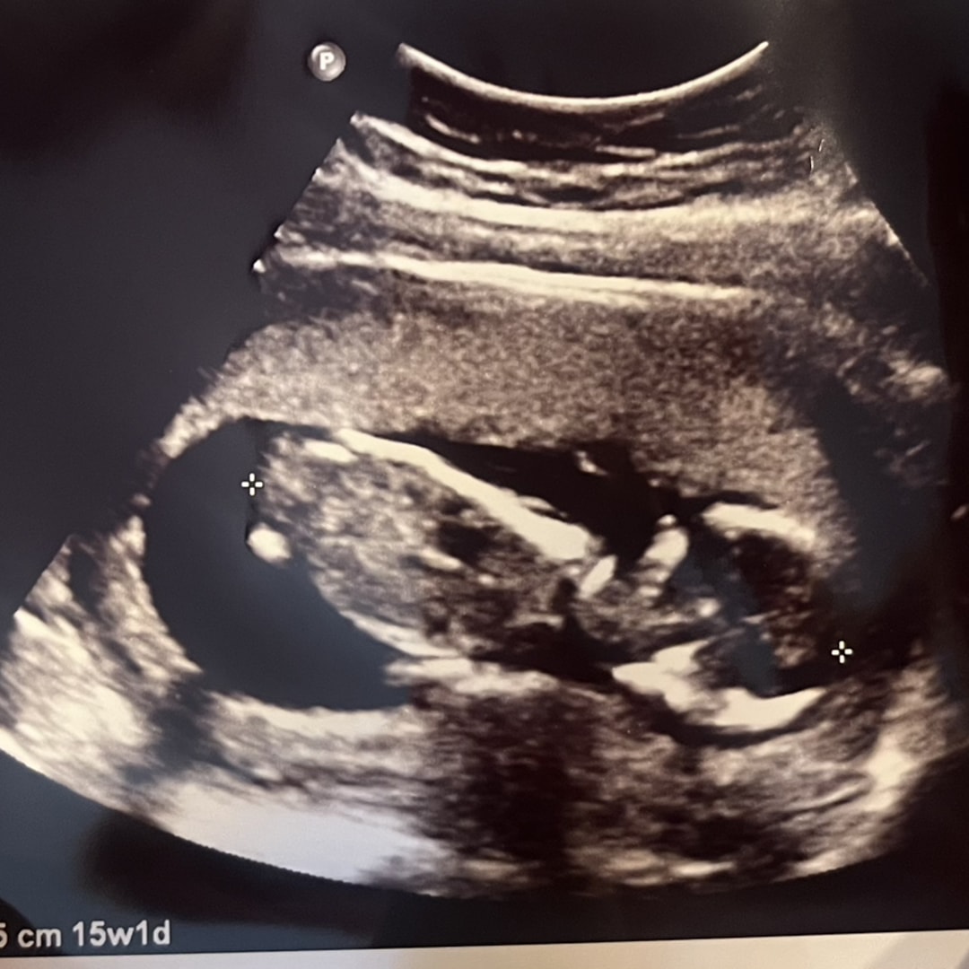 Photo shared by Kiersten for their Babylist baby registry.