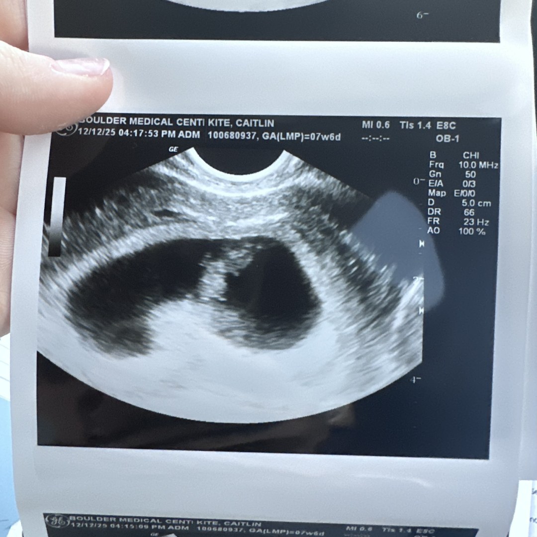 Photo shared by Caitlin for their Babylist baby registry.