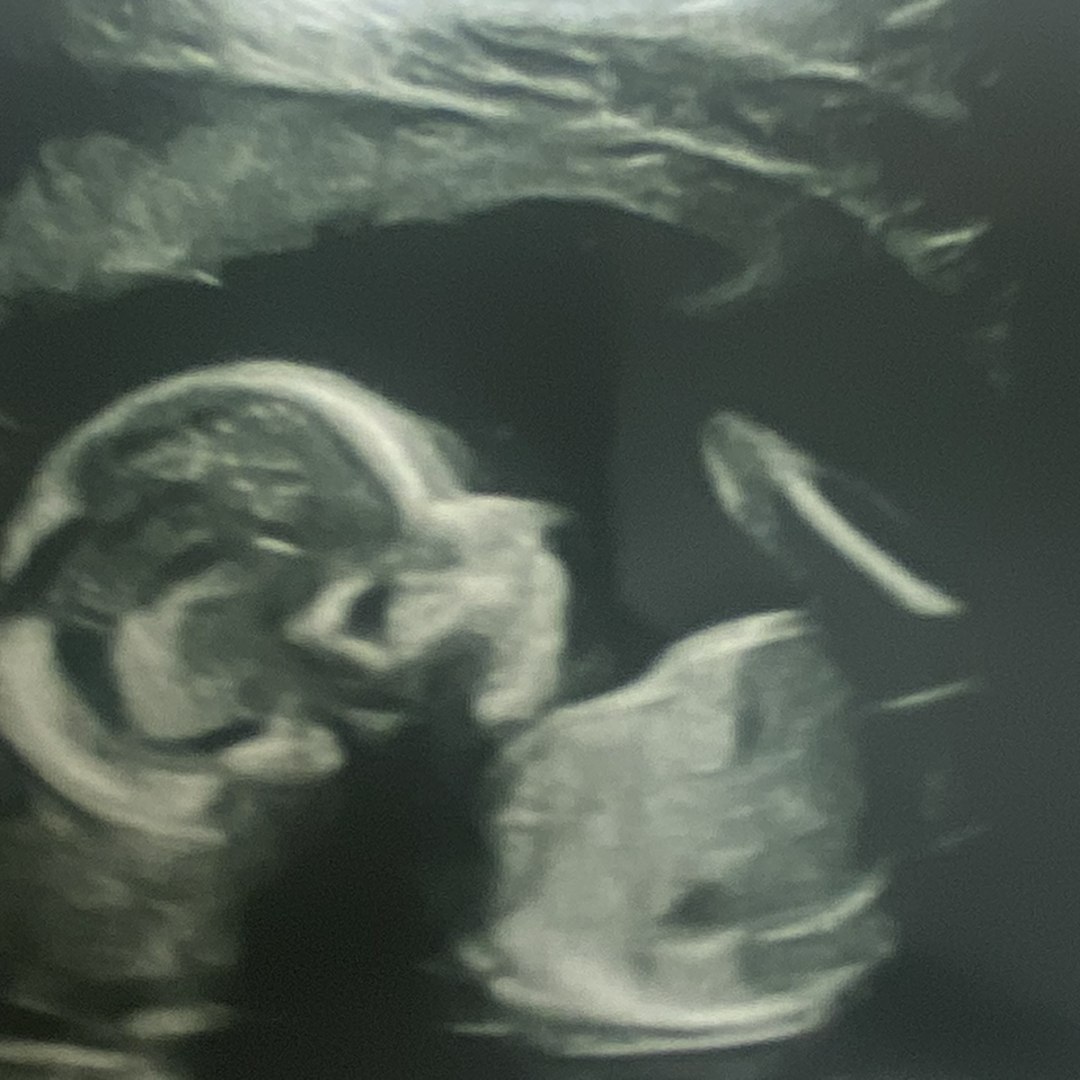 Photo shared by Arlisiya for their Babylist baby registry.