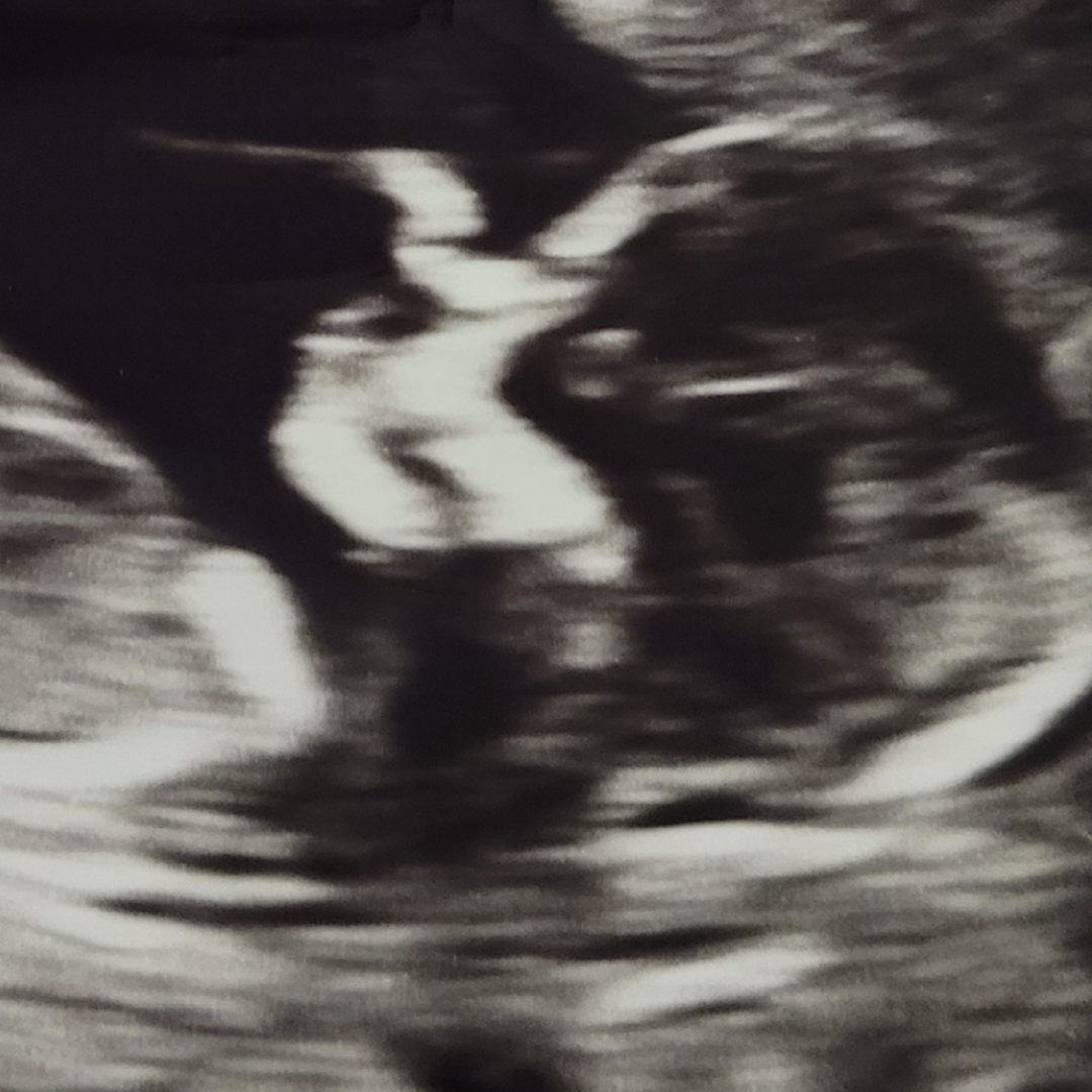 Photo shared by Lisa for their Babylist baby registry.