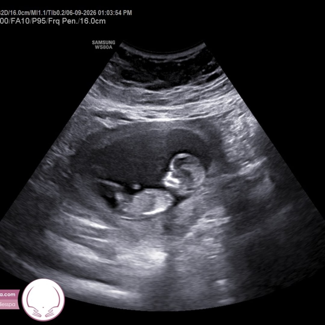 Photo shared by Anna for their Babylist baby registry.