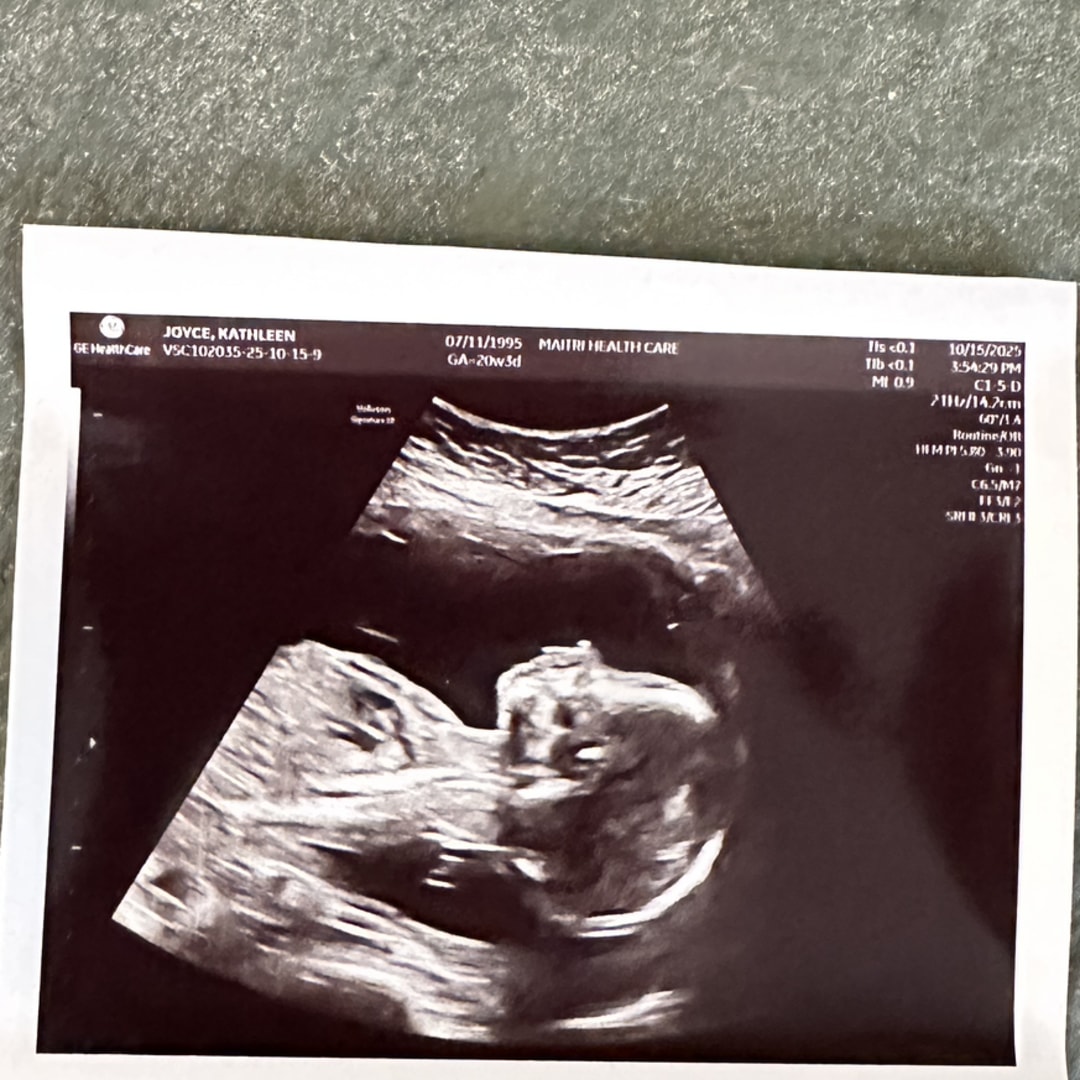 Photo shared by Katie for their Babylist baby registry.