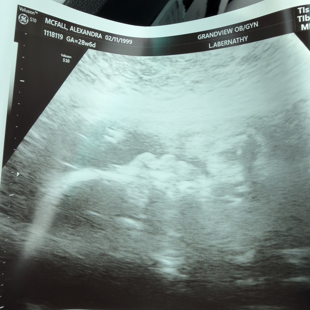 Photo shared by Allie for their Babylist baby registry.