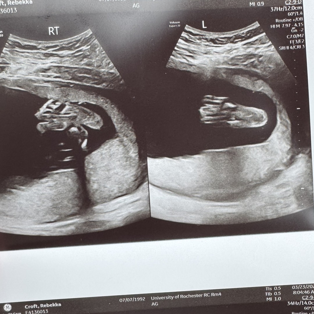 Photo shared by Bekka for their Babylist baby registry.