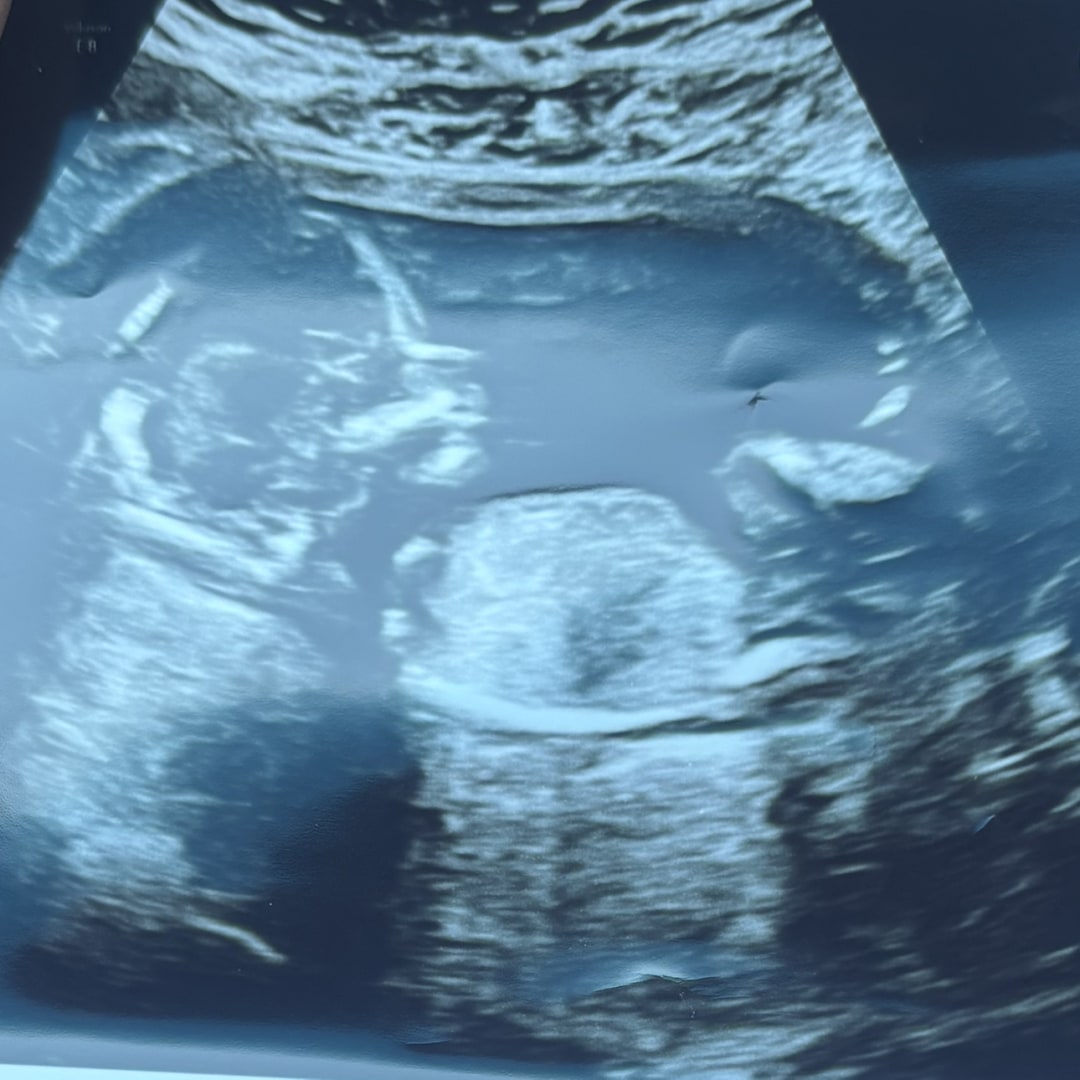 Photo shared by Brooklynne for their Babylist baby registry.