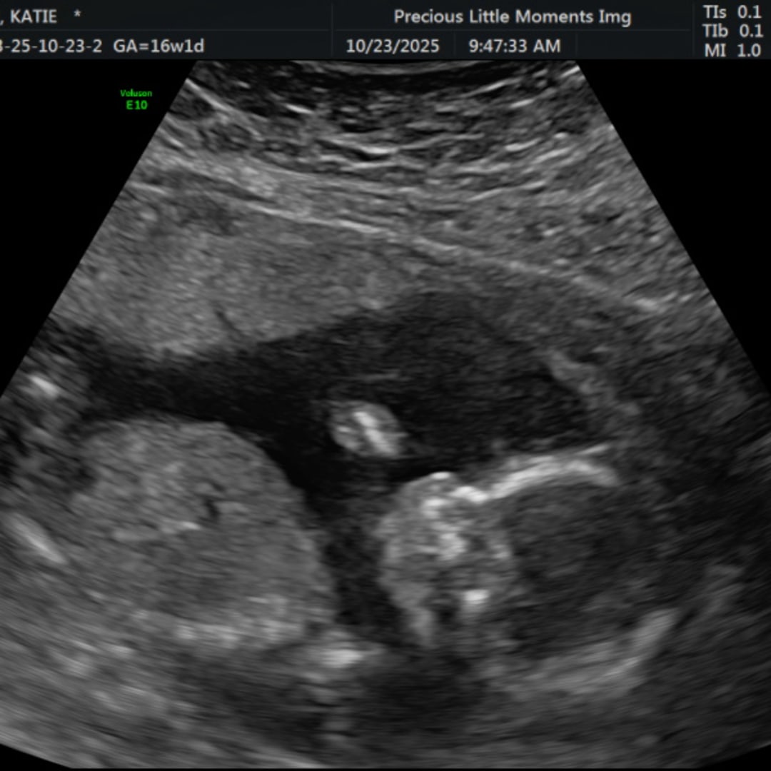 Photo shared by Katie for their Babylist baby registry.