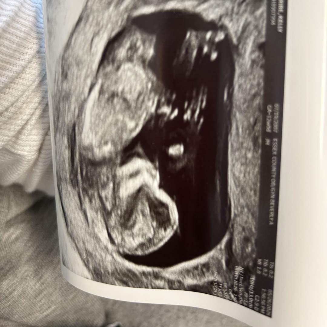 Photo shared by Kelly for their Babylist baby registry.