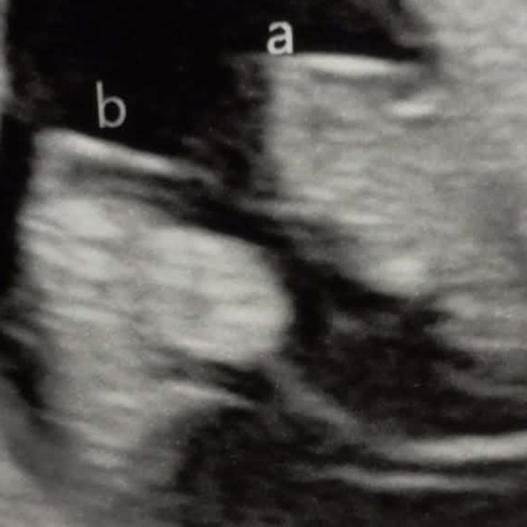 Photo shared by Norma for their Babylist baby registry.