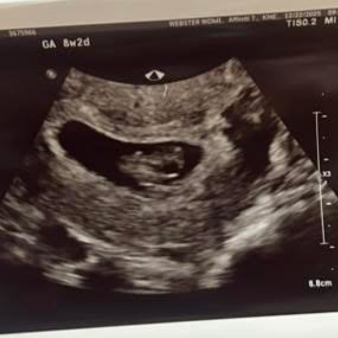 Photo shared by Molly for their Babylist baby registry.