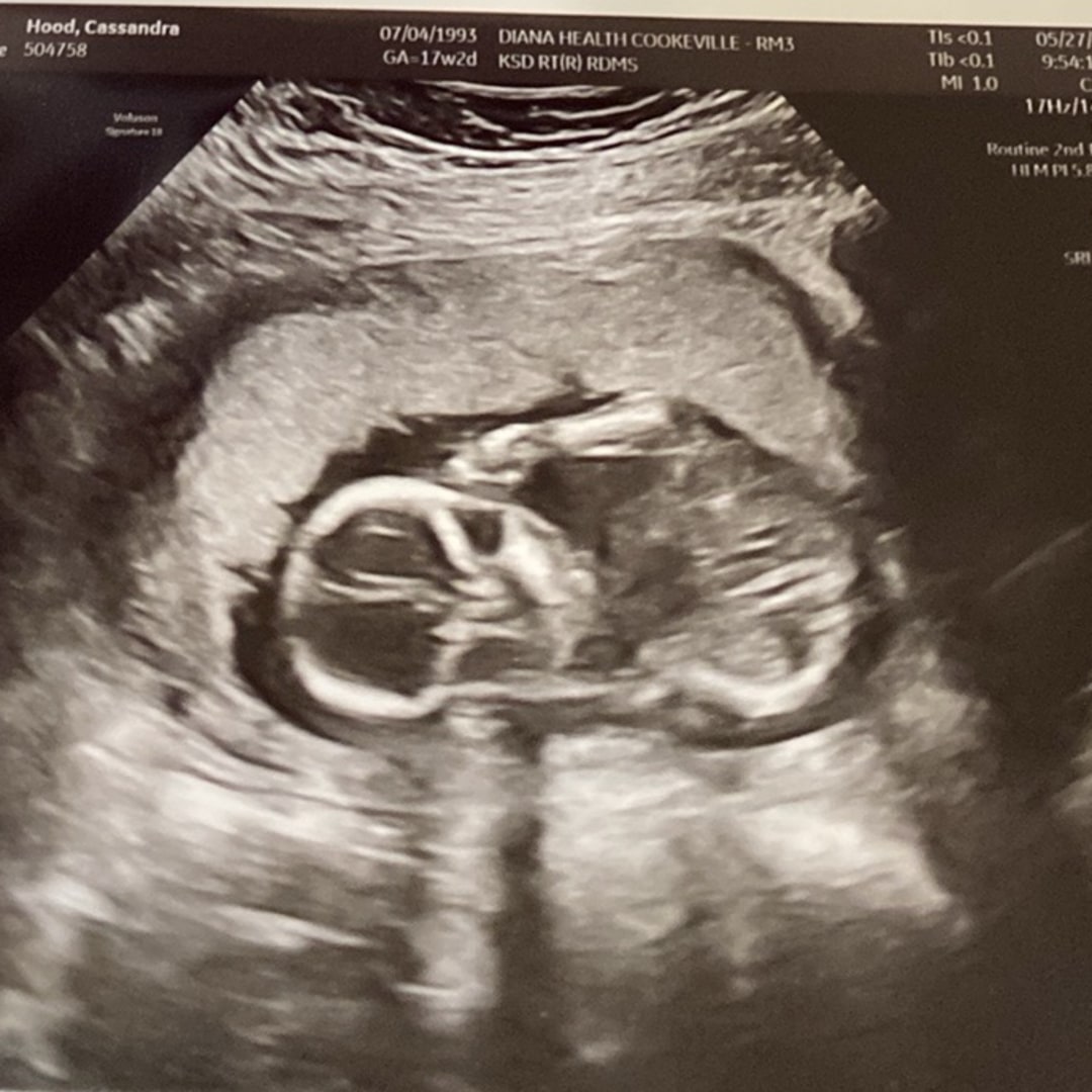 Photo shared by Cassandra for their Babylist baby registry.