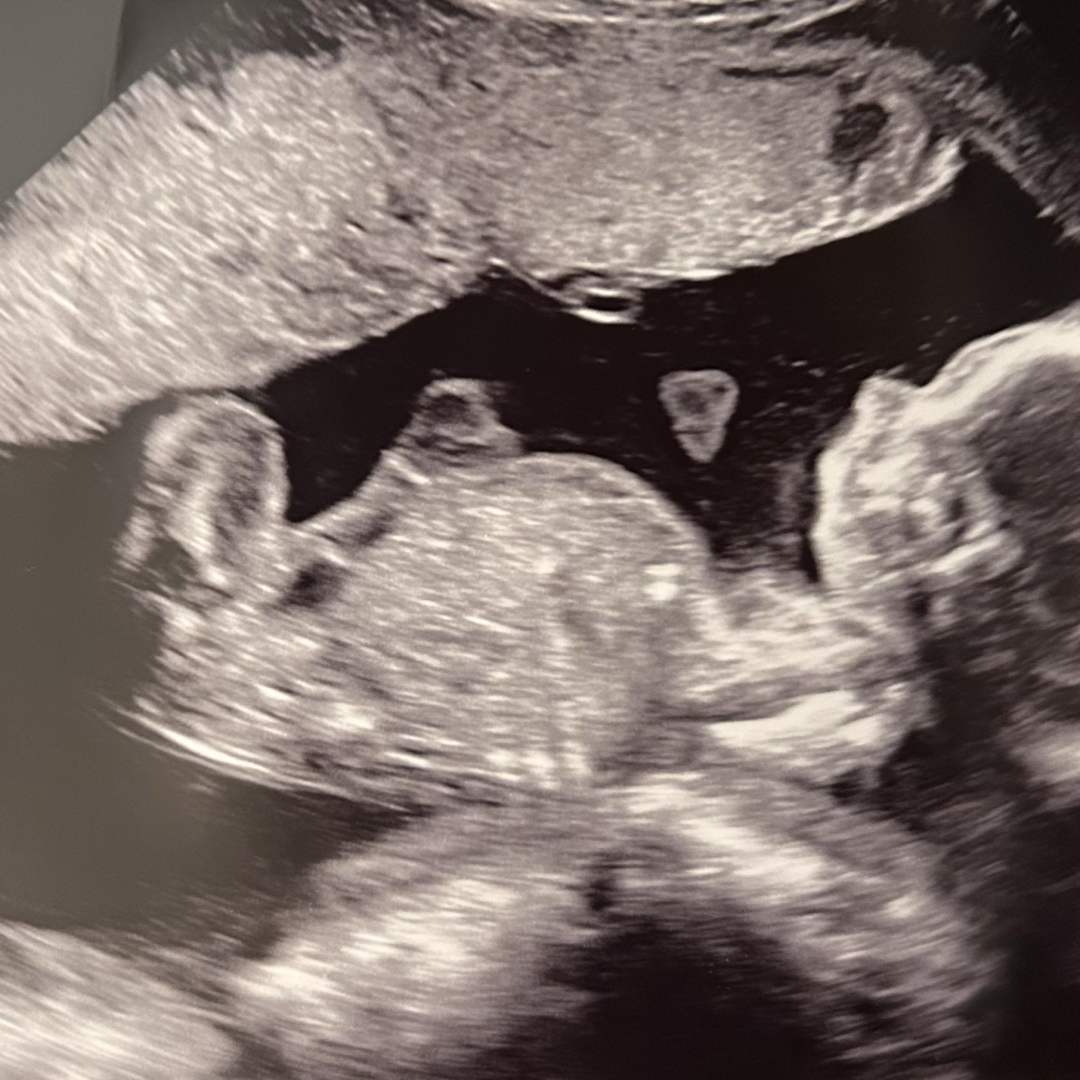 Photo shared by Aria for their Babylist baby registry.