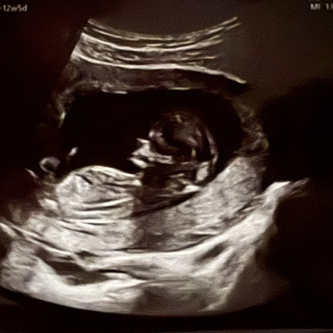 Photo shared by Cory for their Babylist baby registry.