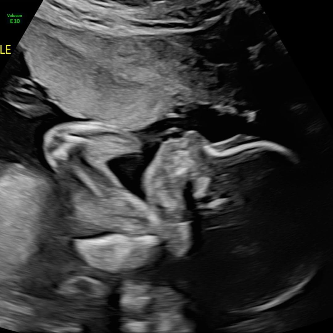 Photo shared by Amariah for their Babylist baby registry.